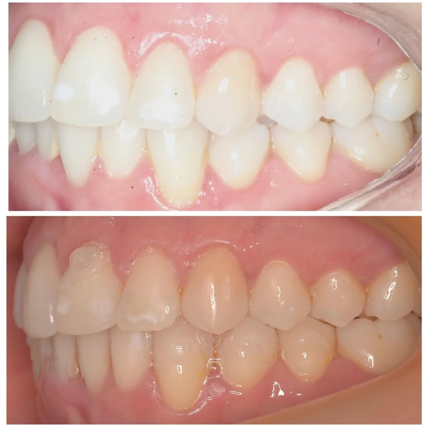 paulopires.dentista_1682367060_3088241196760783216_244918279