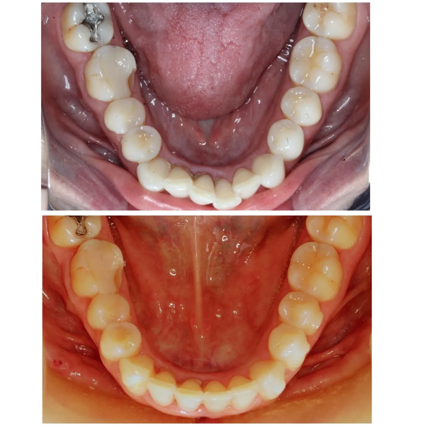 paulopires.dentista_1682367060_3088241196827883765_244918279